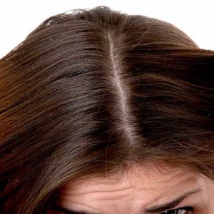 نحوه تشخیص جنس مو و پوست سر